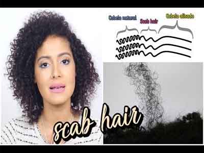 Tratar Scab Hair