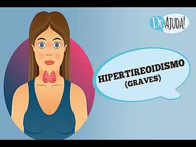 Hipertireoidismo