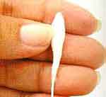 Bananeira luxo: foto 13