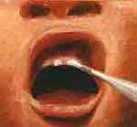 Moleque a Lá Prima: foto 21